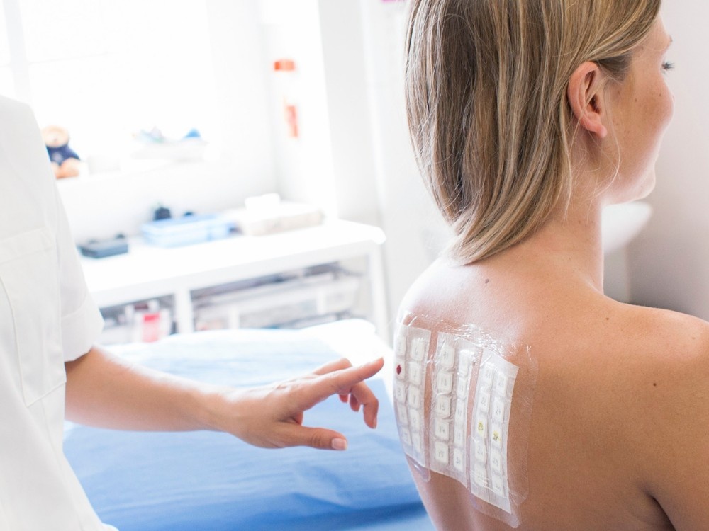 A patient receiving a back patch test for diagnosis, part of professional allergy testing and treatment in Houston.