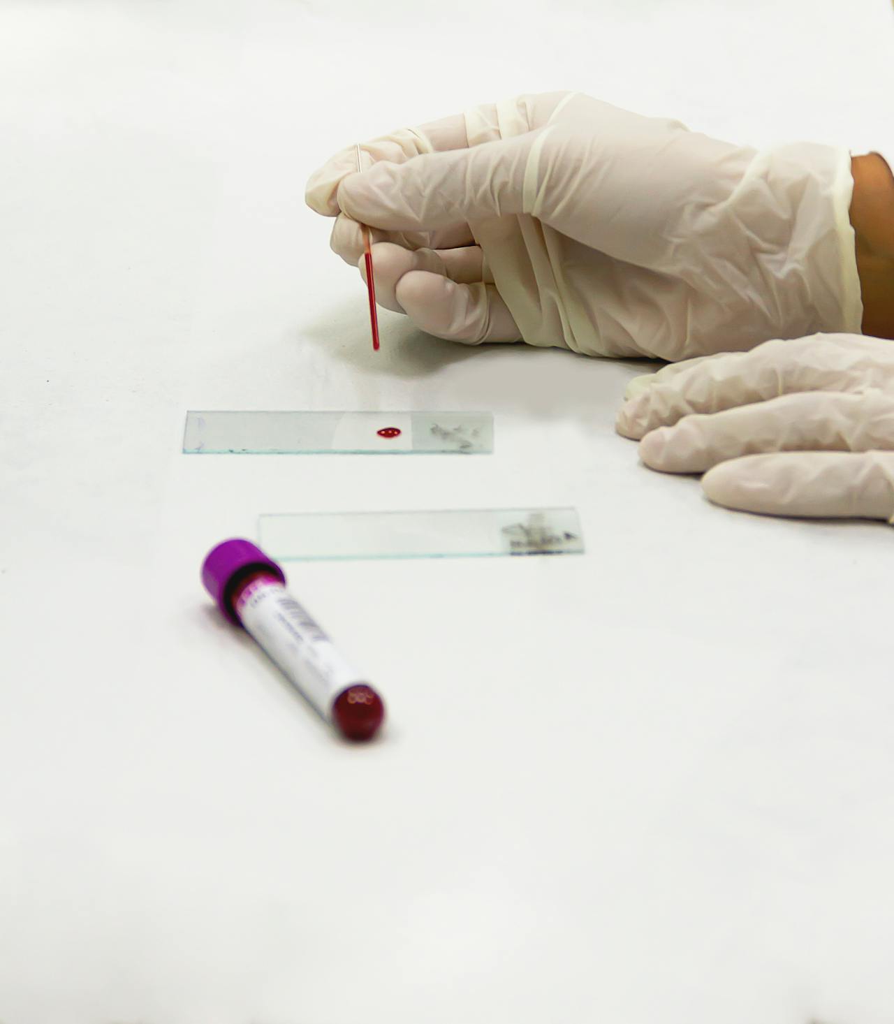 A laboratory professional performing blood sample analysis as part of cheap allergy testing and treatment in Houston.