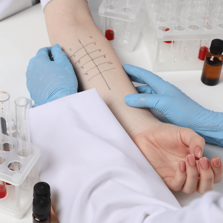 A medical professional performing a skin prick test on a patient's arm, highlighting cheap allergy testing and treatment in Houston.